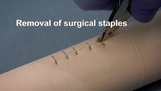 Placing and removing surgical wound closure staples [upl. by Rehpotisrhc]