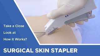 Surgical Skin Stapler Take a Close Look at How it Works [upl. by Neurath]