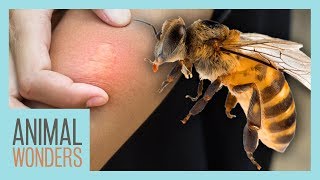 What You Need To Know About Bee Stings [upl. by Ssilb]