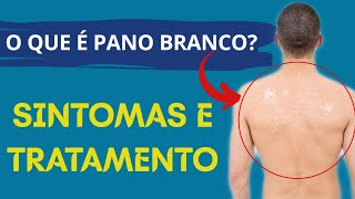 O que é “Pano Branco” Sintomas e tratamento [upl. by Tybald391]